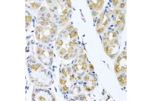 Immunohistochemistry of paraffin-embedded human stomach using TMEM43 antibody.