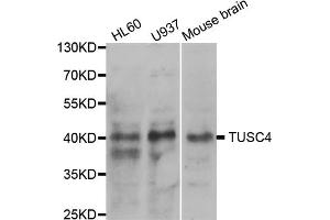 Western blot analysis of extracts of various cell lines, using NPRL2 antibody (ABIN5973470) at 1/1000 dilution. (NPRL2 antibody)