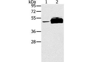 Western Blot analysis of K562 cell and Human testis tissue using PTPN20 Polyclonal Antibody at dilution of 1:200