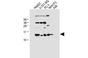 All lanes : Anti-SELK Antibody (Center) at 1:500 dilution Lane 1: HepG2 whole cell lysate Lane 2: U-251 MG whole cell lysate Lane 3: PC-3 whole cell lysate Lane 4: NIH/3T3 whole cell lysate Lane 5: A20 whole cell lysate Lysates/proteins at 20 μg per lane. (Selenoprotein K antibody  (AA 32-61))