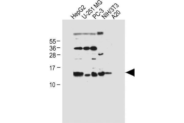 Selenoprotein K Antikörper  (AA 32-61)