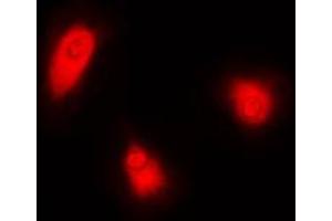 Immunofluorescent analysis of CUGBP1 staining in HeLa cells. (CELF1 antibody  (Center))