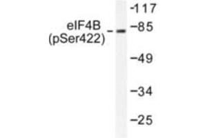 Image no. 1 for anti-Eukaryotic Translation Initiation Factor 4B (EIF4B) (pSer422) antibody (ABIN782456) (EIF4B antibody  (pSer422))
