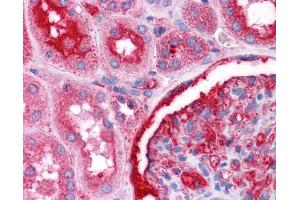 Immunohistochemistry of formalin-fixed, paraffin-embedded human kidney tissue after heat-induced antigen retrieval. (NR4A2 antibody  (N-Term))