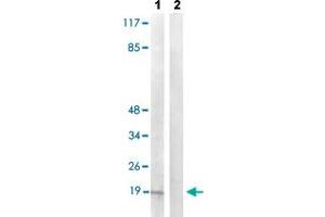 Western blot analysis of Lane 1: TNF treated COS-7 cells, Lane 2: antigen-specific peptide treated COS-7 cells with PEA15 (phospho S104) polyclonal antibody  at 1:500-1:1000 dilution.