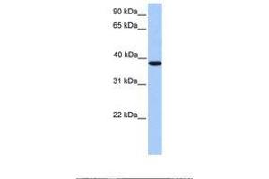 Image no. 1 for anti-Meis Homeobox 1 (MEIS1) (C-Term) antibody (ABIN6737816) (MEIS1 antibody  (C-Term))