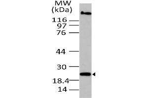 Image no. 1 for anti-Oxidized Low Density Lipoprotein (Lectin-Like) Receptor 1 (OLR1) (AA 1-200) antibody (ABIN5027116) (OLR1 antibody  (AA 1-200))