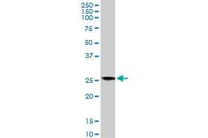 BCAP31 monoclonal antibody (M01A), clone 3C5. (BCAP31 antibody  (AA 137-246))