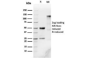 SDS-PAGE Analysis Purified IgM Recombinant Rabbit Monoclonal Antibody (IGHM/3776R). (Recombinant IGHM antibody)