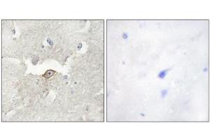 Immunohistochemistry analysis of paraffin-embedded human brain tissue using LMTK2 antibody. (LMTK2 antibody  (Internal Region))