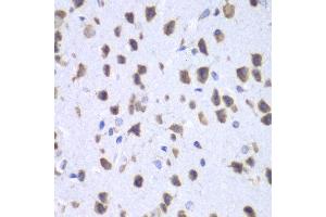 Immunohistochemistry of paraffin-embedded mouse brain using UPF1 antibody at dilution of 1:100 (x40 lens). (RENT1/UPF1 antibody)