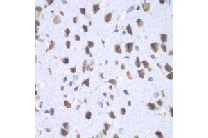 Immunohistochemistry of paraffin-embedded mouse brain using UPF1 antibody at dilution of 1:100 (x40 lens). (RENT1/UPF1 antibody)