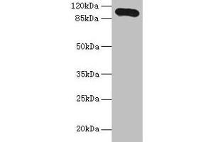 Western blot All lanes: Thbs3 antibody at 16 μg/mL + HepG2 whole cell lysate Secondary Goat polyclonal to rabbit IgG at 1/10000 dilution Predicted band size: 105 kDa Observed band size: 105 kDa (THBS3 antibody  (AA 24-350))