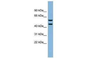 KLHDC4 antibody used at 1 ug/ml to detect target protein. (KLHDC4 antibody  (N-Term))