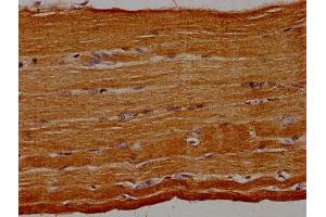 IHC image of ABIN7154440 diluted at 1:30 and staining in paraffin-embedded human skeletal muscle tissue performed on a Leica BondTM system. (GRAP antibody  (AA 1-217))