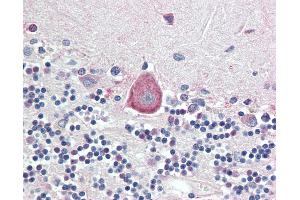 Anti-HOXA10 antibody IHC staining of human brain, cerebellum. (HOXA10 antibody  (AA 152-165))