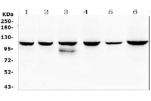 anti-Phosphoinositide-3-Kinase, Catalytic, beta Polypeptide (PIK3CB) (AA 556-598), (Middle Region) antibody