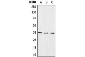 Western blot analysis of RASSF2 expression in HeLa (A), NIH3T3 (B), H9C2 (C) whole cell lysates. (RASSF2 antibody  (Center))