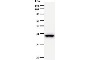 Western Blotting (WB) image for anti-B-Cell CLL/lymphoma 9 (BCL9) antibody (ABIN931006) (BCL9 antibody)