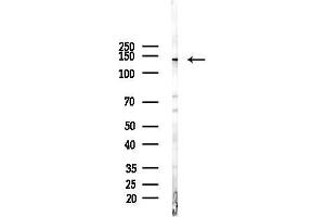 Western blot analysis of lysates from F10-LUC cells(starvation,24h treatment), using ATP2 Antibody at 1/1000 dilution.