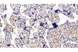 Detection of COL1a1 in Human Placenta Tissue using Monoclonal Antibody to Collagen Type I Alpha 1 (COL1a1) (COL1A1 antibody  (AA 1218-1440))