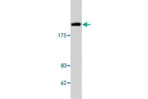 Western blot analysis of Jurkat cell lysate with TOP2B polyclonal antibody .