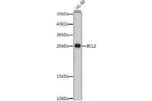 Western blot analysis of extracts of HL-60 cells using Bcl-2 Polyclonal Antibody at dilution of 1:500. (Bcl-2 antibody)
