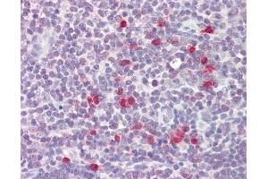 Anti-RCS / ARPP-21 antibody IHC of human thymus. (ARPP21 antibody  (AA 74-123))