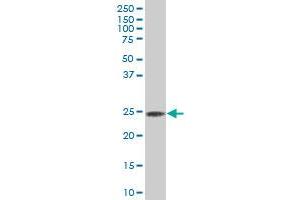 RAB32 polyclonal antibody (A01), Lot # 060126JC01. (RAB32 antibody  (AA 136-225))