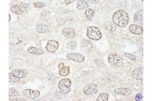 Immunohistochemistry (IHC) image for anti-Nucleoporin 50kDa (NUP50) (AA 418-468) antibody (ABIN7448703) (NUP50 antibody  (AA 418-468))