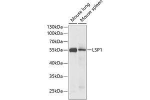 Western blot analysis of extracts of various cell lines, using LSP1 antibody (ABIN6130532, ABIN6143368, ABIN6143370 and ABIN6221252) at 1:1000 dilution. (LSP1 antibody  (AA 1-339))