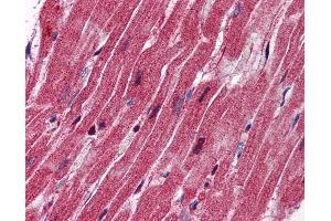 Anti-Nestin antibody IHC of human heart. (Nestin antibody  (AA 1295-1344))