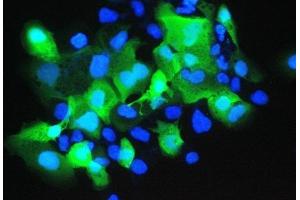 IF analysis of Psoriasin using anti-Psoriasin antibody (ABIN5692925). (S100A7 antibody  (AA 2-101))