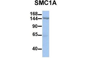 Host:  Rabbit  Target Name:  SMC1A  Sample Type:  Human HepG2  Antibody Dilution:  1. (SMC1A antibody  (C-Term))