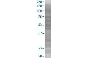 RPS6KB2 transfected lysate. (RPS6KB2 293T Cell Transient Overexpression Lysate(Denatured))
