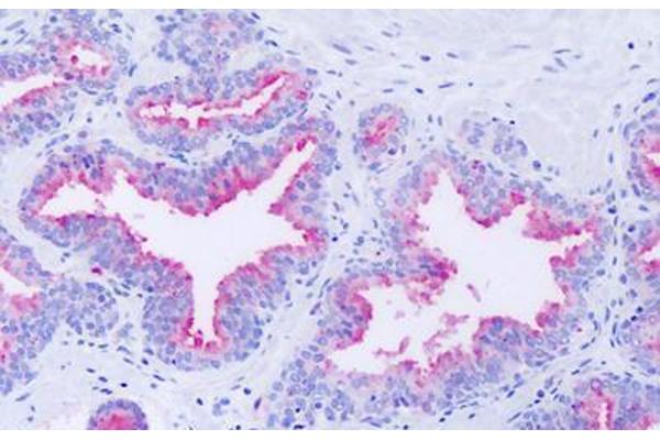 GPR63 antibody  (Extracellular Domain)