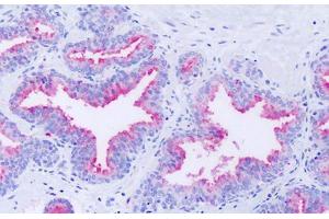 Anti-GPR63 antibody IHC staining of human prostate.