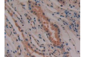 Detection of PTGDS in Human Kidney Tissue using Polyclonal Antibody to Prostaglandin-H2 D-isomerase (PTGDS) (PTGDS antibody  (AA 32-190))