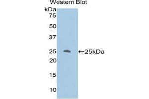 Western blot analysis of the recombinant protein. (PKC zeta antibody  (AA 404-591))