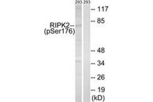 Western blot analysis of extracts from 293 cells treated with UV 15', using RIPK2 (Phospho-Ser176) Antibody. (RIPK2 antibody  (pSer176))