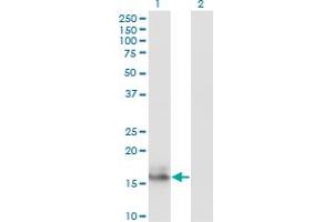 Western Blot analysis of AGR2 expression in transfected 293T cell line by AGR2 monoclonal antibody (M01), clone 1E5. (AGR2 antibody  (AA 1-175))
