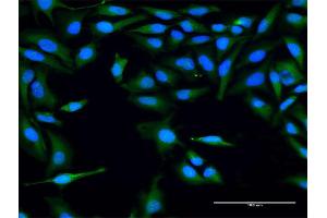 Immunofluorescence of purified MaxPab antibody to FLJ22662 on HeLa cell. (FLJ22662 (AA 1-223) antibody)