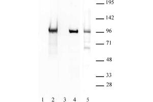 BORIS / CTCFL antibody (pAb) tested by Western blot. (CTCFL antibody  (N-Term))