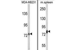 (LEFT) Western blot analysis of LTF Antibody in MDA-MB231 cell line lysates (35ug/lane). (Lactoferrin antibody)