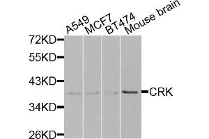 Western blot analysis of extracts of various cell lines, using CRK antibody. (Crk antibody)