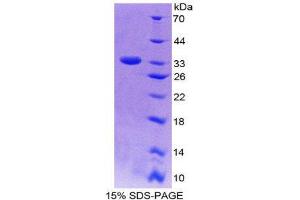 SDS-PAGE (SDS) image for Latent Transforming Growth Factor beta Binding Protein 2 (LTBP2) (AA 522-814) protein (His tag) (ABIN2125613) (LTBP2 Protein (AA 522-814) (His tag))
