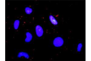 Proximity Ligation Analysis of protein-protein interactions between FGFR1 and CREBBP. (CBP antibody  (AA 951-1050))