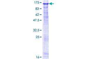 NCAPH Protein (AA 1-741) (GST tag)