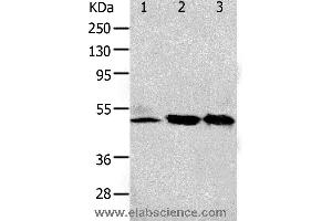 Western blot analysis of 293T and K562 cell, human fetal kidney tissue, using F2R Polyclonal Antibody at dilution of 1:650 (PAR1 antibody)