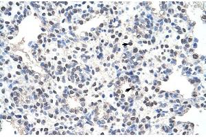 Rabbit Anti-NCL Antibody Catalog Number: ARP40583 Paraffin Embedded Tissue: Human Lung Cellular Data: Alveolar cells Antibody Concentration: 4. (Nucleolin antibody  (N-Term))